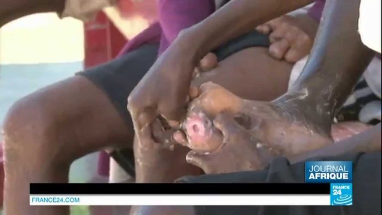 VIDEO. A Madagascar, la lèpre continue à faire des victimes